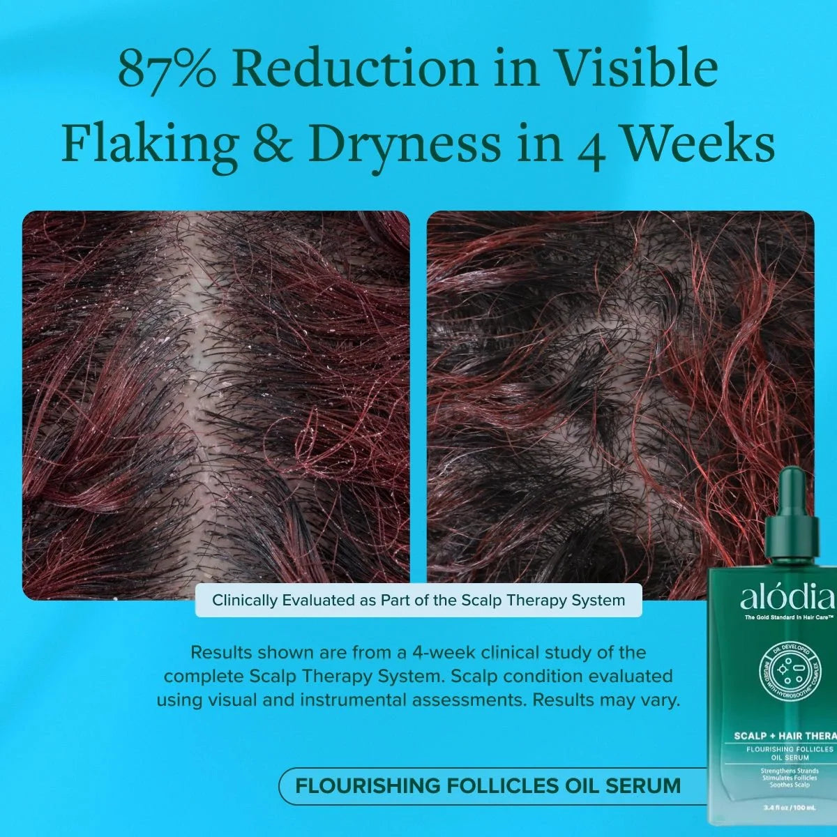 Flourishing Follicles Oil Serum