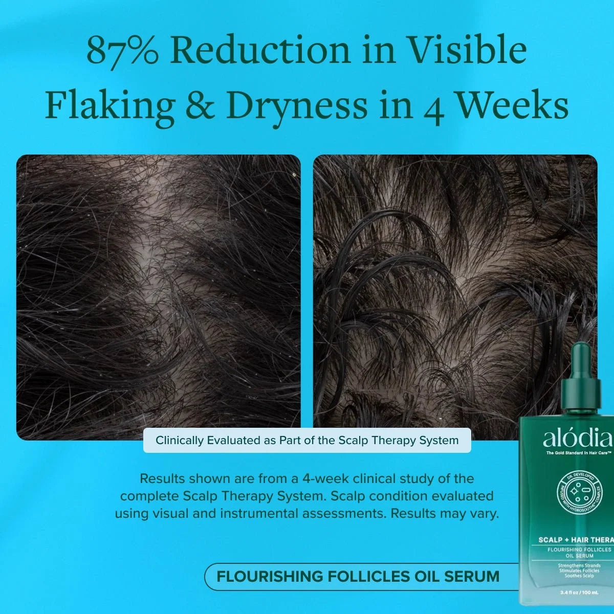 Flourishing Follicles Oil Serum