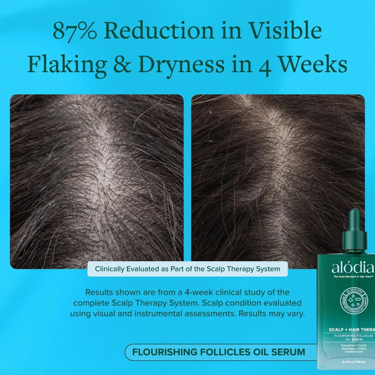 Flourishing Follicles Oil Serum