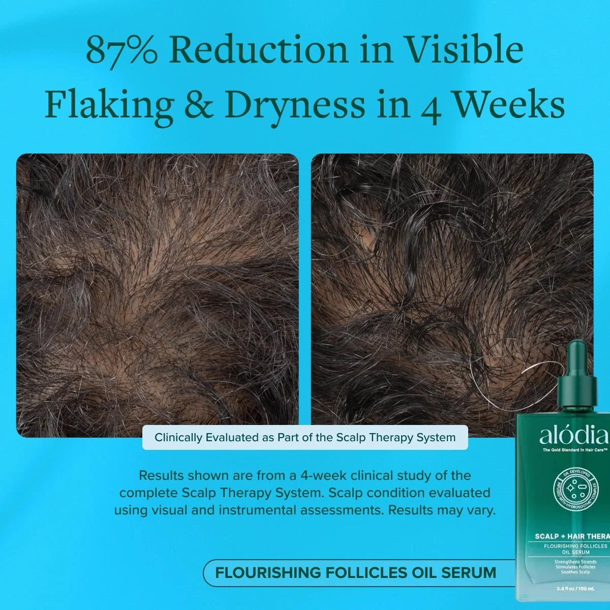 Flourishing Follicles Oil Serum