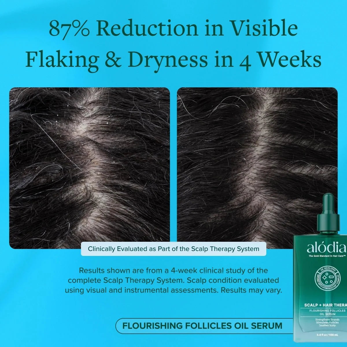 Flourishing Follicles Oil Serum