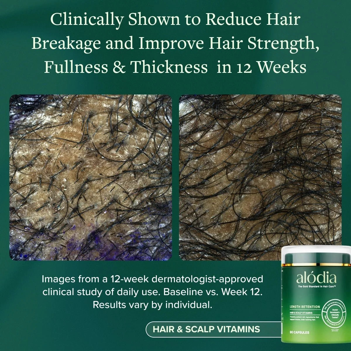 Hair & Scalp Vitamins