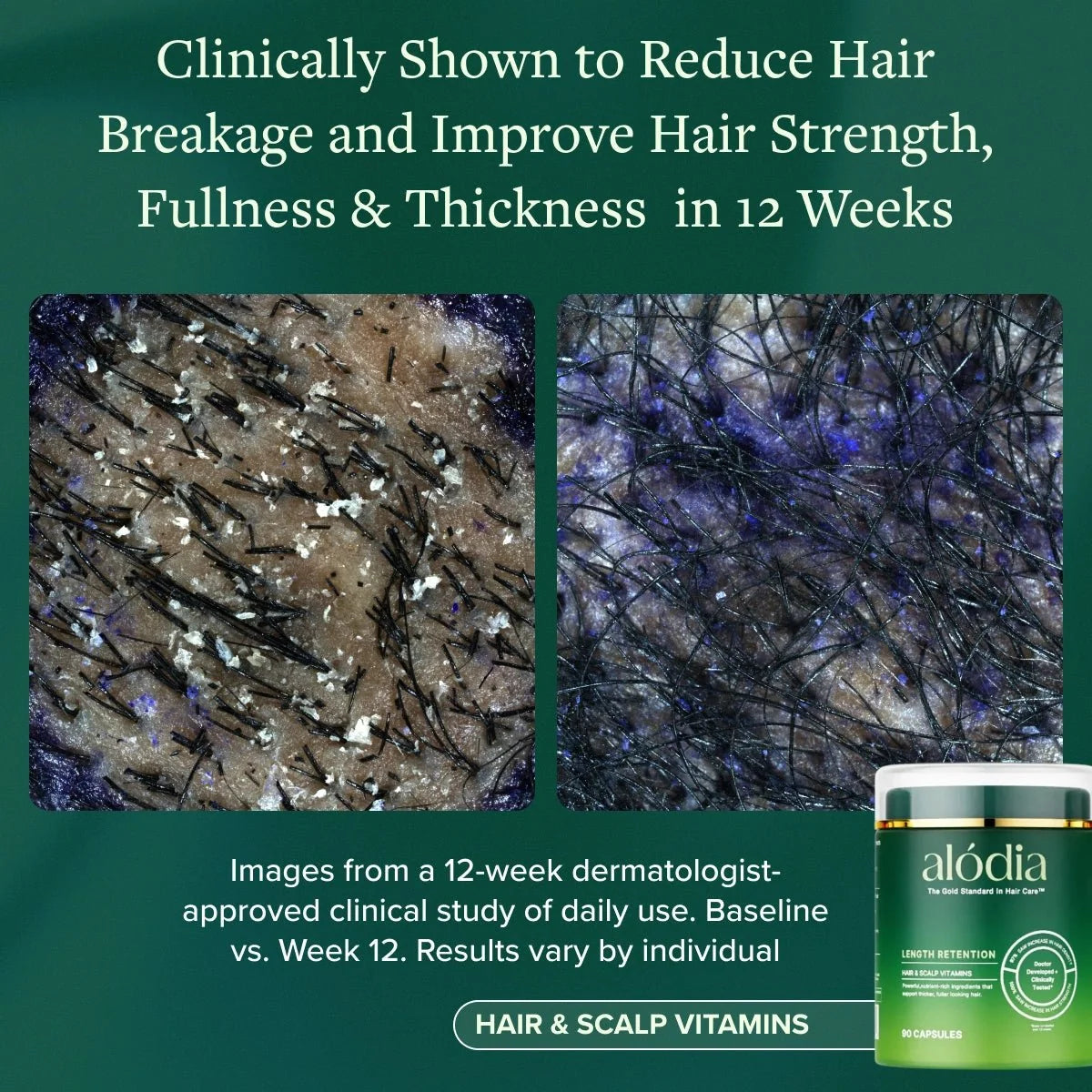 Hair & Scalp Vitamins