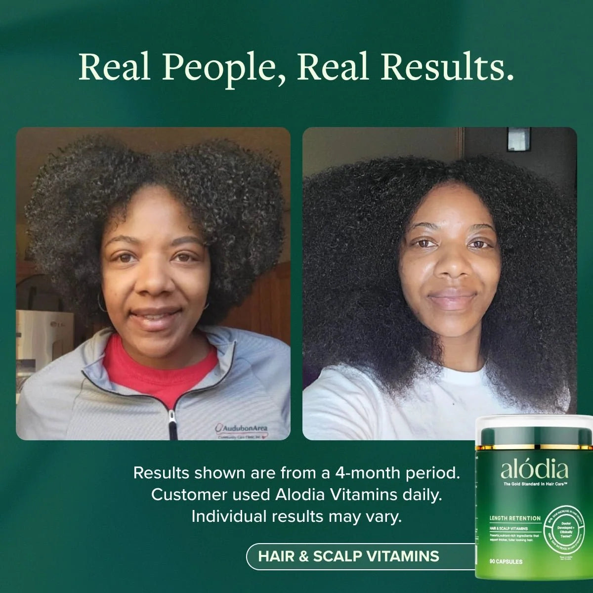 Hair & Scalp Vitamins