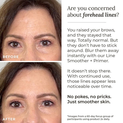 Line Smoother + Primer with Neodermyl®