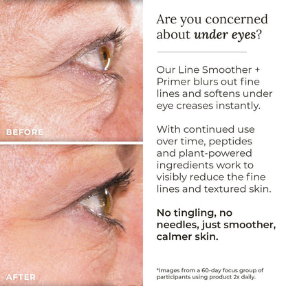 Line Smoother + Primer with Neodermyl®