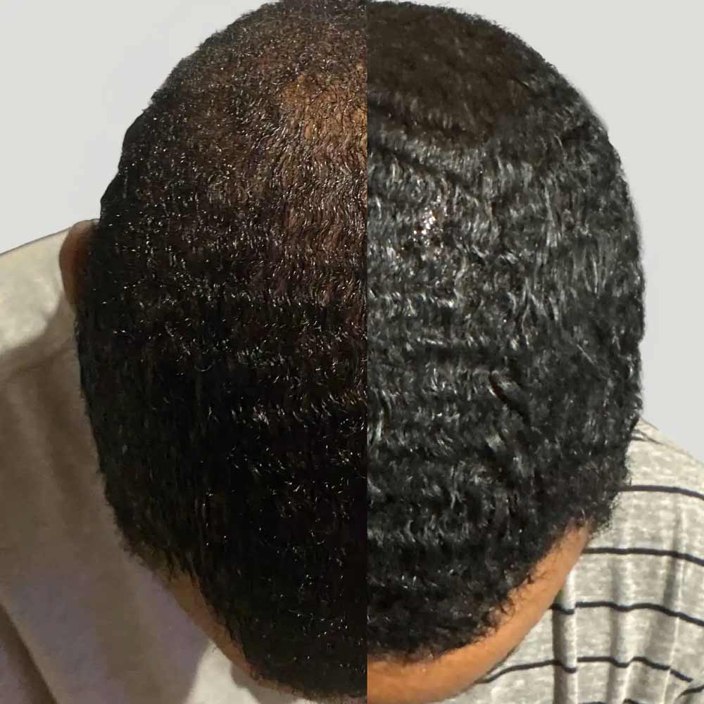 MARO17 Fuller Hair Collagen Scalp Treatment