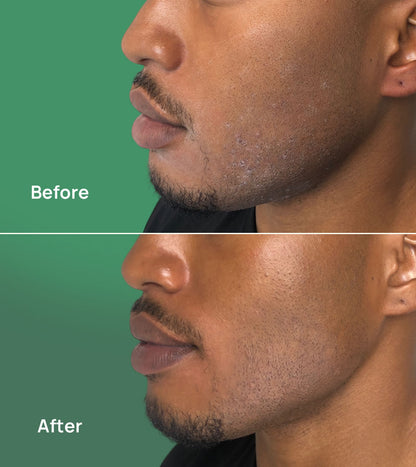 Hydrating Facial Serum