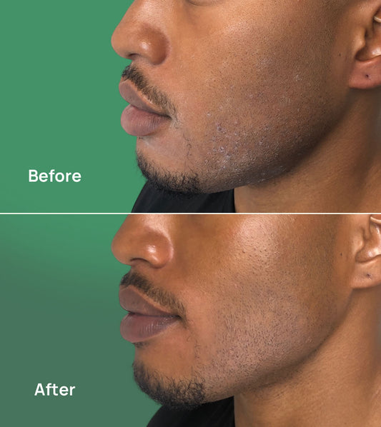 Hydrating Facial Serum