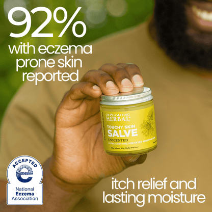 Ungüento para pieles sensibles, crema para eczema