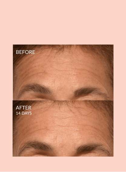 Masque Moléculaire Triple Lift